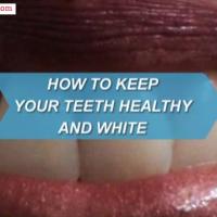 How to Keep Your Teeth Healthy and White